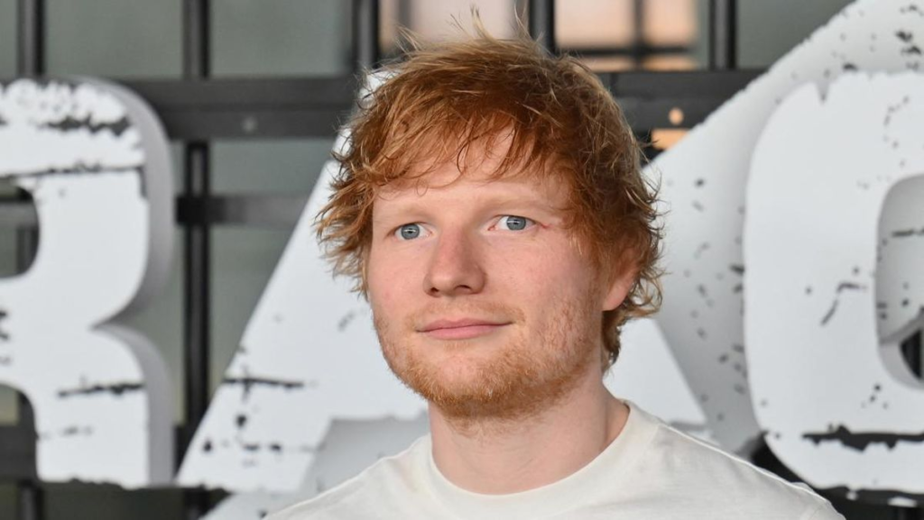 Ed Sheeran Berani Akui Diagnosis Herpes, Kisah Tersembunyi yang Akhirnya Terungkap